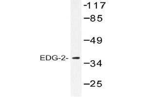 Image no. 1 for anti-Lysophosphatidic Acid Receptor 1 (LPAR1) antibody (ABIN317688) (LPAR1 抗体)