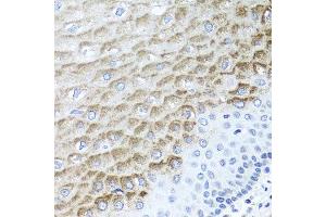 Immunohistochemistry of paraffin-embedded human esophagus using F3 antibody at dilution of 1:100 (x40 lens). (Tissue factor 抗体)
