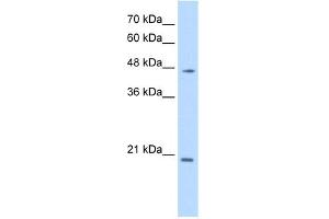 WB Suggested Anti-PAX6 Antibody Titration:  0. (PAX6 抗体  (N-Term))