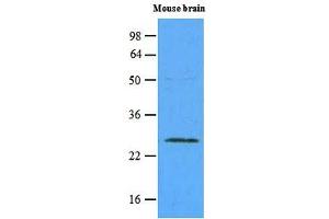 Western blot analysis: The extracts of mouse brain (45ug) were resolved by SDS-PAGE, transferred to NC membrane and probed with anti-human Rab5a (1:500). (RAB5 抗体)
