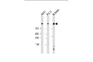 All lanes : Anti-DYNC1H1 Antibody (C-term) at 1:2000 dilution Lane 1: A431 whole cell lysate Lane 2: PC-3 whole cell lysate Lane 3: mouse brain lysate Lysates/proteins at 20 μg per lane. (DYNC1H1 抗体  (C-Term))