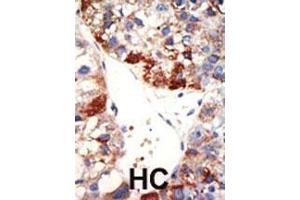 Immunohistochemistry (Paraffin-embedded Sections) (IHC (p)) image for anti-Negative Regulator of Ubiquitin-Like Proteins 1 (NUB1) (AA 87-117), (N-Term) antibody (ABIN389078)