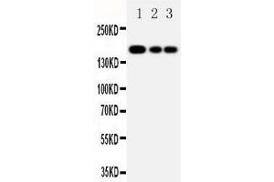 Anti-MRP1 antibody, Western blotting Lane 1: JURKAT Cell Lysate Lane 2: CEM Cell Lysate Lane 3: A549 Cell Lysate (ABCC1 抗体  (C-Term))