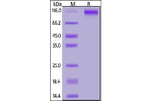 SDS-PAGE (SDS) image for SARS-CoV-2 Spike S1 (Active) protein (His tag) (ABIN7013239)