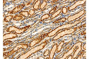 ABIN6265692 and ABIN6276452 at 1/100 staining Rat kidney tissue by IHC-P.