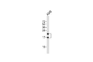 Anti-FGF2 Antibody at 1:2000 dilution + A549 whole cell lysates Lysates/proteins at 20 μg per lane.