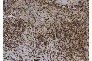 ABIN6259844 and ABIN6277505 at 1/100 staining Human spleen tissue by IHC-P. (AIMP1 抗体  (Internal Region))
