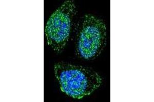 Confocal immunofluorescent analysis of IL17B with Hela cells using Interleukin-17B / IL17B  Antibody , followed by Alexa Fluor 488-conjugated goat anti-rabbit lgG (green). (IL17B 抗体  (Middle Region))