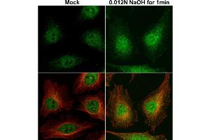 ICC/IF Image Cofilin 1 antibody detects Cofilin 1 protein at cytoplasm and nucleus by immunofluorescent analysis. (Cofilin 抗体)
