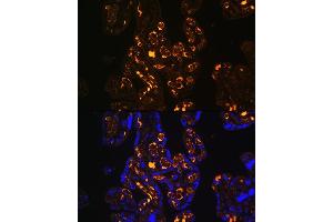Immunofluorescence analysis of Human placenta using ApoER2/ApoER2/LRP8 antibody (ABIN6134224, ABIN6143337, ABIN6143338 and ABIN6214801) at dilution of 1:100. (LRP8 抗体  (C-Term))