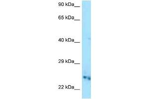WB Suggested Anti-Cmpk1 Antibody Titration: 1. (Cytidine Monophosphate (UMP-CMP) Kinase 1, Cytosolic (CMPK1) (C-Term) 抗体)