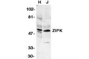 Western blot analysis of ZIP kinase in HeLa (H) and Jurkat (J) whole cell lysates with ZIAP31006PU-N at 1 μg/ml. (DAPK3 抗体  (Center))
