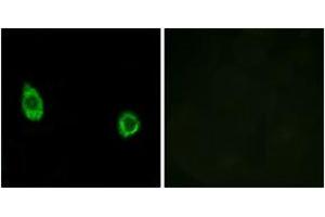 Immunofluorescence analysis of HuvEc cells, using CHST9 Antibody. (CHST9 抗体  (AA 361-410))