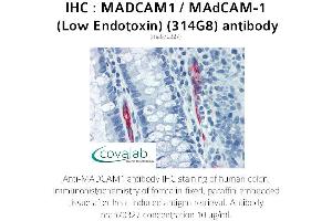 Image no. 2 for anti-Mucosal Vascular Addressin Cell Adhesion Molecule 1 (MADCAM1) antibody (ABIN5693628) (MADCAM1 抗体)