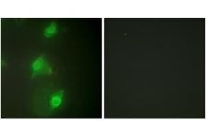 Immunofluorescence analysis of HeLa cells, using AIRE Antibody. (AIRE 抗体  (AA 91-140))