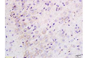 Formalin-fixed and paraffin embedded rat brain labeled with Anti-TLR1 Polyclonal Antibody, Unconjugated (ABIN736373) at 1:200 followed by conjugation to the secondary antibody and DAB staining. (TLR1 抗体  (AA 101-200))