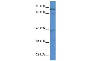 WB Suggested Anti-ZCCHC7 Antibody Titration: 0. (ZCCHC7 抗体  (C-Term))