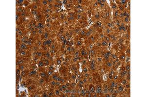 Immunohistochemistry of Human brain  using ENTPD7 Polyclonal Antibody at dilution of 1:40 (ENTPD7 抗体)