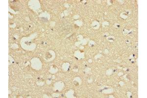 Immunohistochemistry of paraffin-embedded human brain tissue using ABIN7148022 at dilution of 1:100 (COPZ1 抗体  (AA 1-177))
