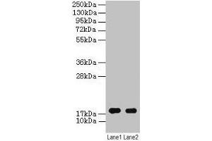Western blot All lanes: ATP5F1D antibody at 2 μg/mL Lane 1: EC109 whole cell lysate Lane 2: 293T whole cell lysate Secondary Goat polyclonal to rabbit IgG at 1/15000 dilution Predicted band size: 18 kDa Observed band size: 18 kDa (ATP5F1D 抗体  (AA 32-158))