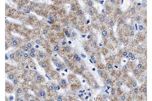 ABIN6267543 at 1/100 staining human liver tissue sections by IHC-P. (Tuberin 抗体  (pThr1462))