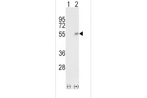 Western blot analysis of HP (arrow) using rabbit polyclonal HP Antibody (Center) (ABIN652875 and ABIN2842566). (Haptoglobin 抗体  (Center))