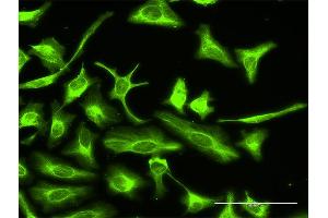 Immunofluorescence of purified MaxPab antibody to OTUB2 on HeLa cell. (OTUB2 抗体  (AA 1-234))
