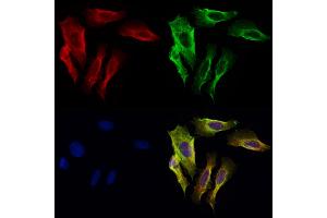 ABIN6264940 and ABIN6272667 staining Hela cells by IF/ICC.