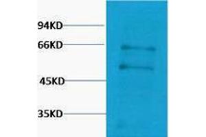 Western Blotting (WB) image for anti-Myc Proto-Oncogene protein (MYC) antibody (ABIN3181293) (c-MYC 抗体)