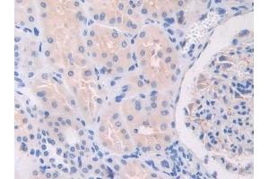 Immunohistochemistry (IHC) image for anti-Toll-Like Receptor 3 (TLR3) (AA 404-532) antibody (ABIN7434491)