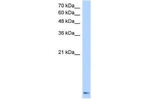 Transfected 293T; WB Suggested Anti-ZNF706 Antibody Titration: 0. (ZNF706 抗体  (N-Term))