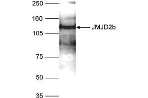 Western Blot of anti-JMJD2b antibody Western Blot results of Rabbit anti-JMJD2b antibody.