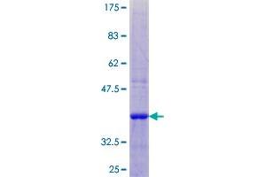 LY6E Protein (AA 1-131) (GST tag)