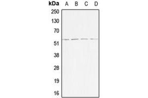 Western blot analysis of ACVR1B expression in HeLa (A), Jurkat (B), SP2/0 (C), H9C2 (D) whole cell lysates. (Activin A Receptor Type IB/ALK-4 抗体  (Center))