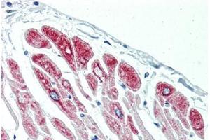 Human Heart (formalin-fixed, paraffin-embedded) stained with DES antibody ABIN396919 at 10 ug/ml followed by biotinylated anti-mouse IgG secondary antibody ABIN481714, alkaline phosphatase-streptavidin and chromogen. (Desmin 抗体)