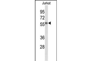 Western blot analysis of SACM1L Antibody (C-term) (ABIN653512 and ABIN2842917) in Jurkat cell line lysates (35 μg/lane). (SACM1L 抗体  (C-Term))