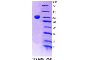 SDS-PAGE analysis of Mouse PNPO Protein. (PNPO 蛋白)