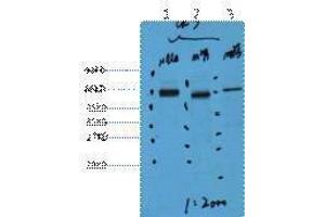 Western Blotting (WB) image for anti-Keratin 7 (KRT7) antibody (ABIN3181124) (Cytokeratin 7 抗体)