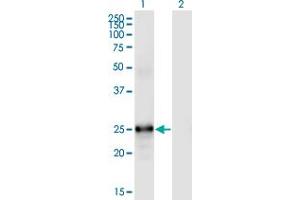 FGF19 anticorps  (AA 1-216)
