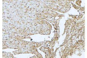 ABIN6273408 at 1/100 staining Mouse muscle tissue by IHC-P. (TNNT3 抗体  (C-Term))