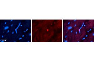 Rabbit Anti-APTX Antibody   Formalin Fixed Paraffin Embedded Tissue: Human heart Tissue Observed Staining: Nucleus Primary Antibody Concentration: 1:100 Other Working Concentrations: N/A Secondary Antibody: Donkey anti-Rabbit-Cy3 Secondary Antibody Concentration: 1:200 Magnification: 20X Exposure Time: 0. (Aprataxin 抗体  (N-Term))