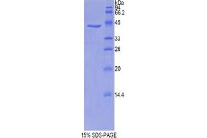 SDS-PAGE analysis of Mouse Profilin 1 Protein. (PFN1 蛋白)