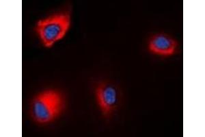 Immunofluorescent analysis of ANAPC1 (pS688) staining in HEK293T cells. (APC1 抗体  (pSer688))