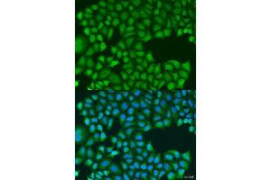 Immunofluorescence analysis of U2OS cells using TIRAP antibody. (TIRAP 抗体  (AA 1-221))