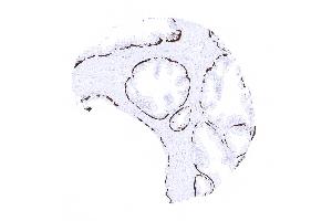 Strong KRT14 positivity in basal cells of the prostate (Recombinant KRT14 抗体  (AA 350-472))