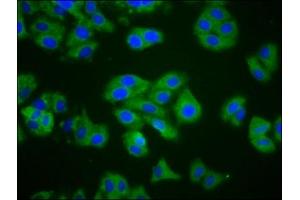 Immunofluorescence staining of HepG2 cells with ABIN7148706 at 1:200, counter-stained with DAPI. (CTAGE1 抗体  (AA 471-595))
