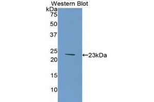 Western blot analysis of the recombinant protein. (COL6A1 抗体  (AA 828-1022))
