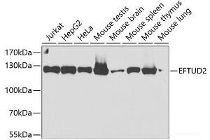 Western blot analysis of extracts of various cell lines using EFTUD2 Polyclonal Antibody at dilution of 1:2000. (EFTUD2 抗体)