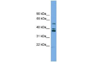 WB Suggested Anti-LDLRAD3 Antibody Titration: 0.