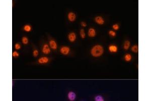 Immunofluorescence analysis of HeLa cells using EFTUD2 Polyclonal Antibody at dilution of 1:100. (EFTUD2 抗体)
